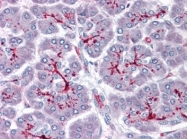AP23549PU-N - SLAIN1