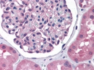 AP23552PU-N - Nephrin