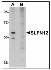 AP23570PU-N - SLFN12