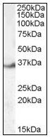 AP23573PU-N - LASP1