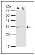 AP23580PU-N - Arginase-1