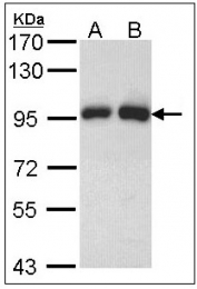 AP23589PU-N - Gelsolin
