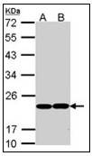 AP23590PU-N - Glutathione peroxidase 1 / GPX1