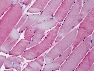 AP23594PU-N - OSBPL1A