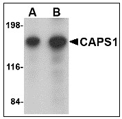 AP23465PU-N - CADPS