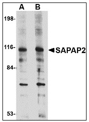 AP23467PU-N - DLGAP2