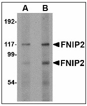 AP23472PU-N - FNIP2