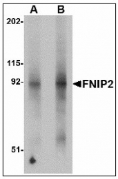 AP23474PU-N - FNIP2