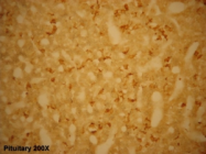 20070 - Adrenocorticotropic Hormone (ACTH)