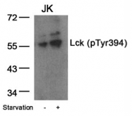 AP02429PU-N - LCK