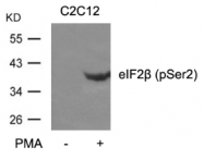 AP26039PU-S - EIF2B / EIF2S2