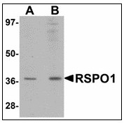 AP23479PU-N - RSPO1
