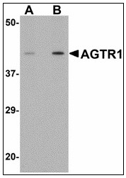 AP23488PU-N - Type-1 angiotensin II receptor (AT1)