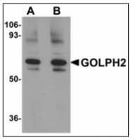 AP23490PU-N - Golgi membrane protein 1 / GOLM1