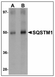 AP23491PU-N - SQSTM1
