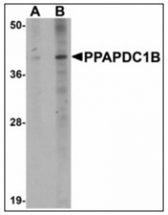 AP23498PU-N - PPAPDC1B