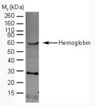 AP05441SU-L - Hemoglobin