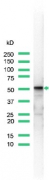 AM11201PU-S - Vimentin
