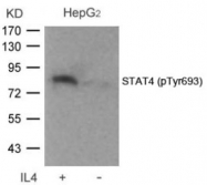 AP02346PU-S - STAT4