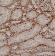 BM422 - Fibronectin