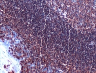 AP15440PU-S - CD4