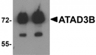 AP26156PU-N - ATAD3B