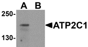 AP26124PU-N - ATP2C1