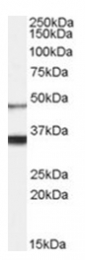 AP31067PU-N - Orexin receptor type 1