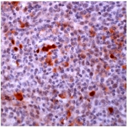 AP15593PU-M - HDAC2