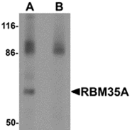 AP26107PU-N - ESRP1 / RBM35A