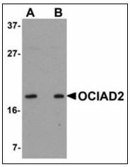 AP23913PU-N - OCIAD2