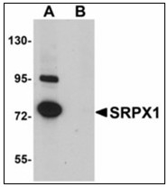 AP23914PU-N - SRPX / ETX1