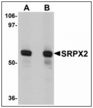 AP23915PU-N - SRPX2 / SRPUL