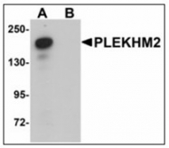 AP23916PU-N - PLEKHM2