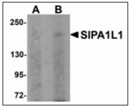 AP23918PU-N - SIPA1L1