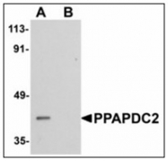 AP23922PU-N - PPAPDC2