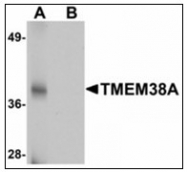 AP23924PU-N - TMEM38A