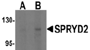 AP26166PU-N - Myospryn