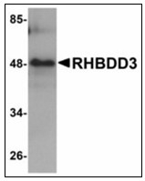 AP23926PU-N - RHBDD3