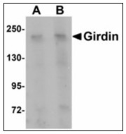 AP23928PU-N - Girdin