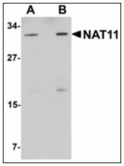 AP23929PU-N - NAT11