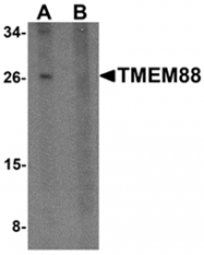 AP26160PU-N - TMEM88 / TMEM88A