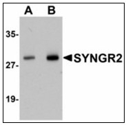 AP23935PU-N - Synaptogyrin-2 / SYNGR2