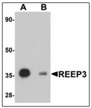 AP23937PU-N - REEP3