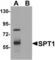 AP26144PU-N - Vasohibin-1 / VASH1