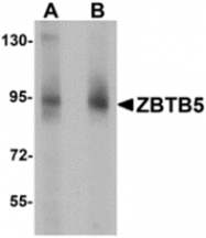 AP26083PU-N - ZBTB5
