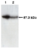 AM05385PU-N - CCT2 / TCP1 beta