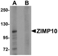 AP26131PU-N - ZMIZ1 / RAI17