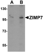 AP26130PU-N - ZMIZ2