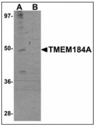 AP23953PU-N - TMEM184A